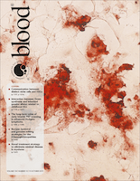 The hazards of blood transfusion in historical perspective